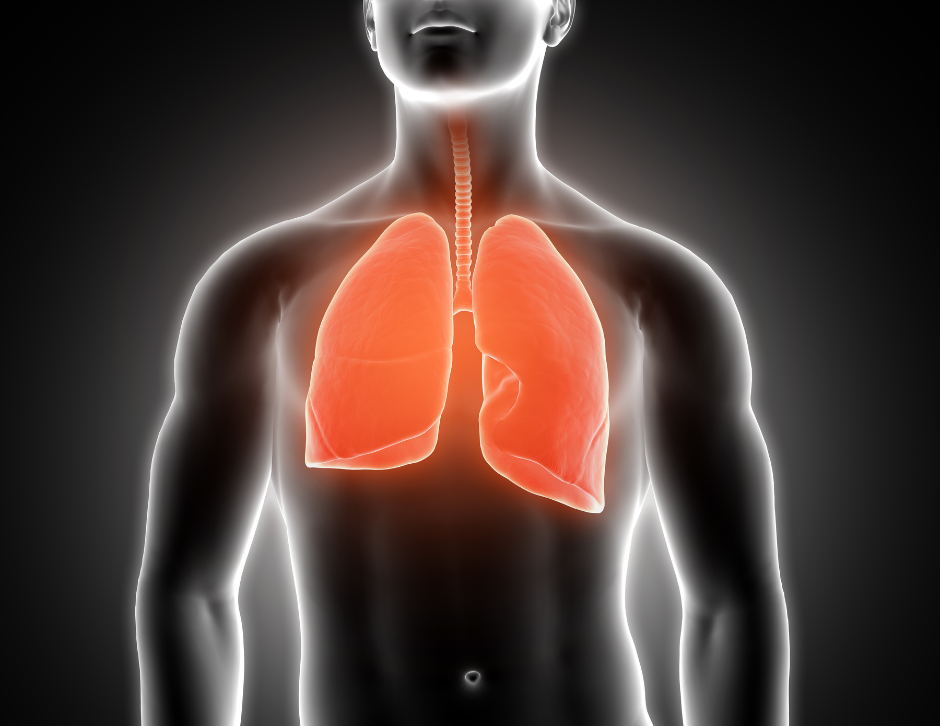 Terapia de apoyo en el tratamiento de pulmonía con el sistema láser MLS