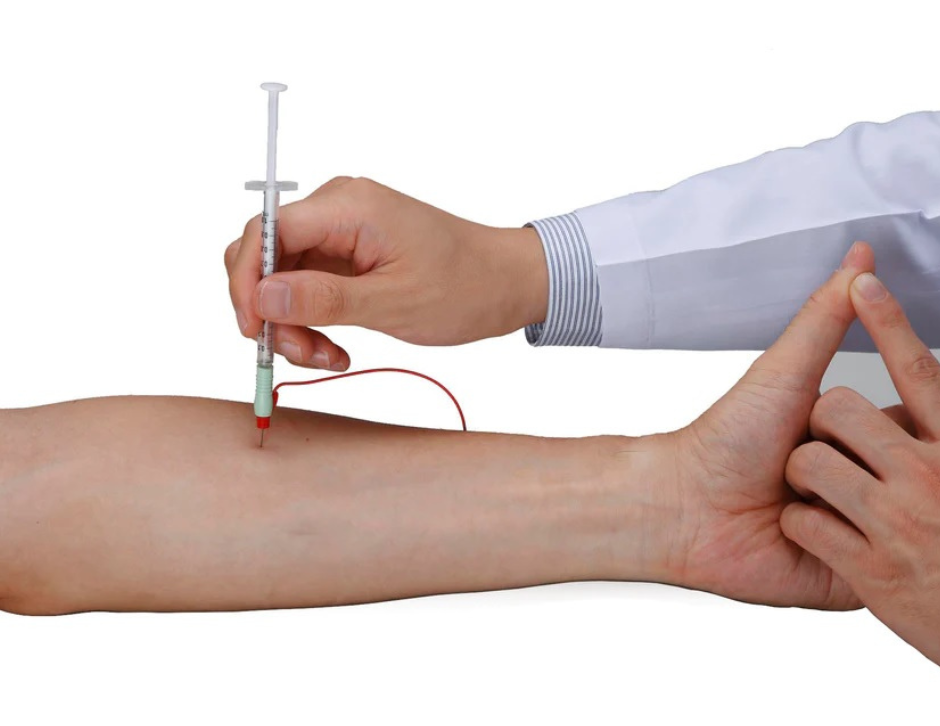 Electromiografía y electroestimulación como técnicas guía para aplicación de inyección de toxina botulínica